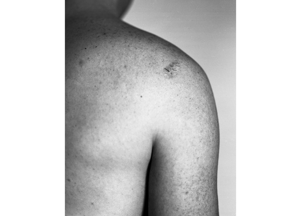 Scar #3, 2013.