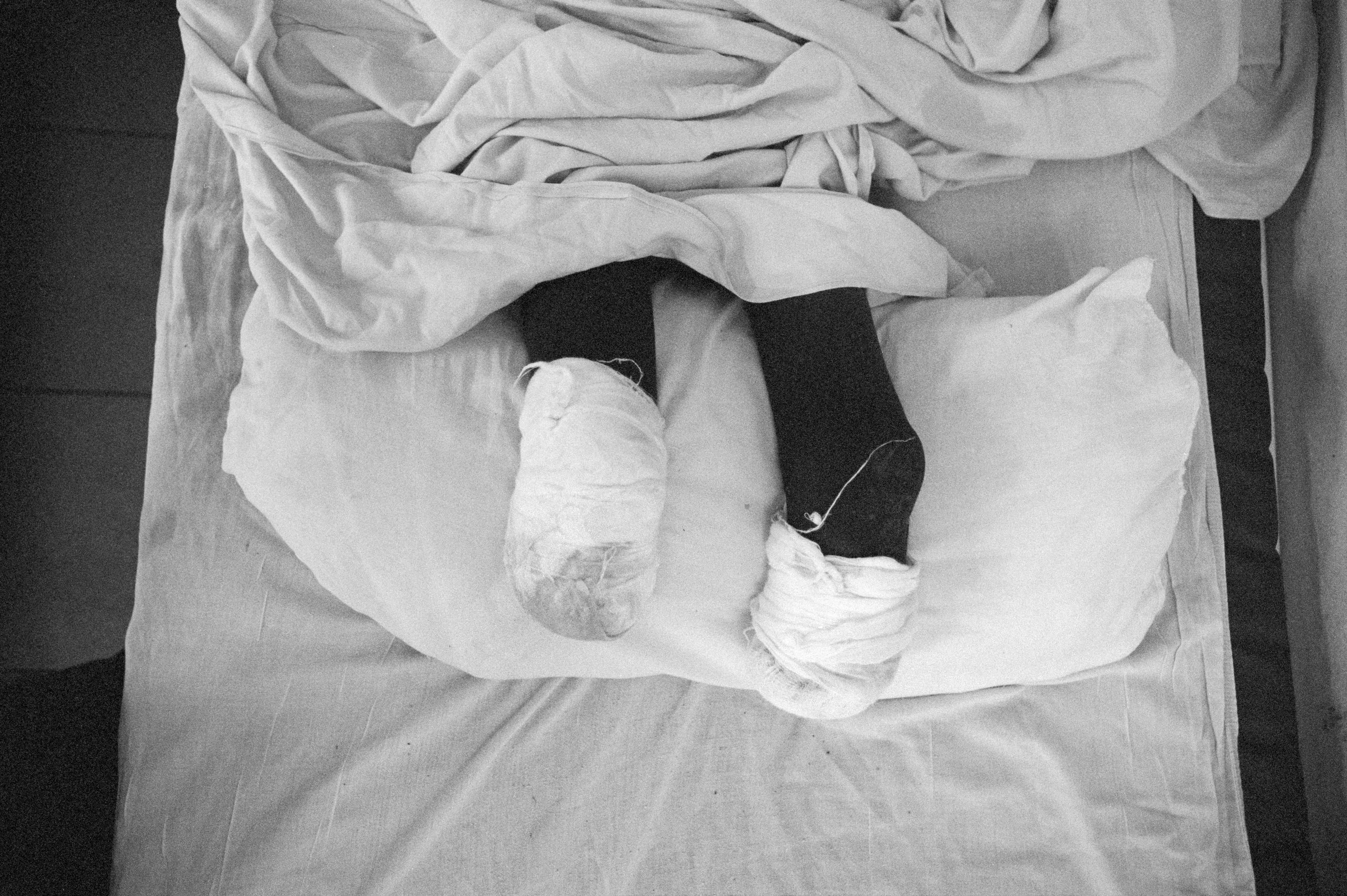 Sapalo in hospital. Luena. Dec 2017